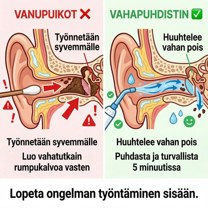 Waxcleaner – Älykäs korvien puhdistus vain 5 minuutissa